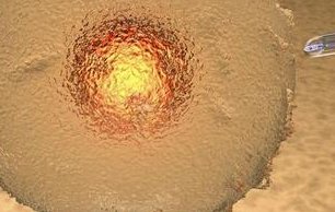 染色体易位在上饶市第五人民医院可以做三代试管吗？染色体平衡易位还能生健康的宝宝吗？